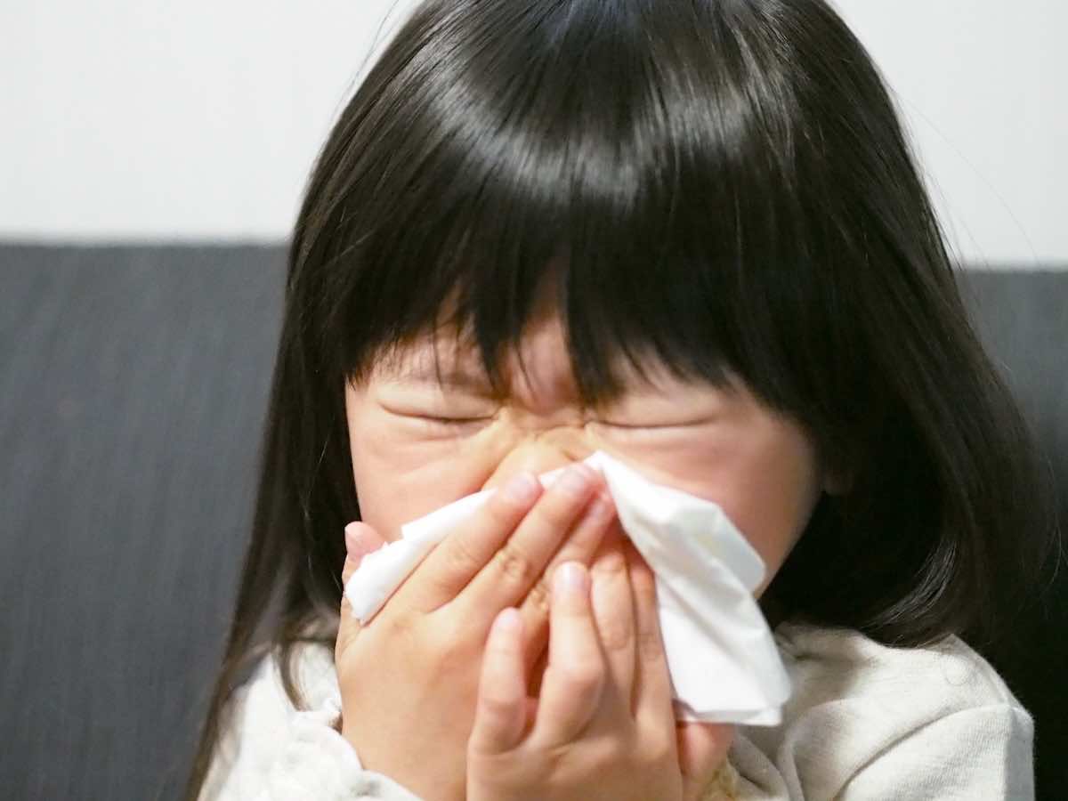 幼児期のアレルギーとは？年齢別の特徴と原因・対策を徹底解説